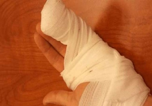 دبي.. حبس عامل قطع إصبعين من يد زميله بسبب "رشفة شاي"