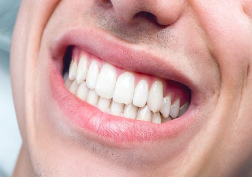 أطباء: الإجهاد الوبائي يؤدي إلى زيادة في صرير الأسنان