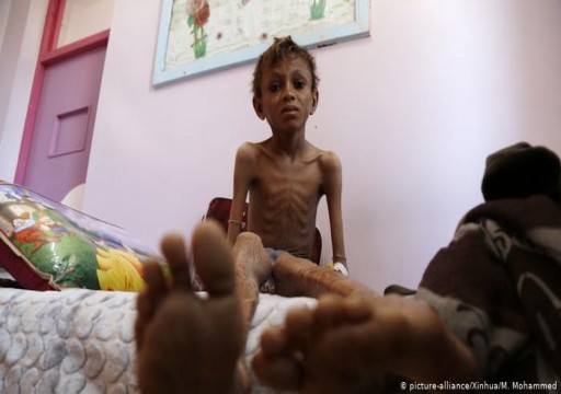 الأمم المتحدة تحذر من سوء تغذية قياسي بين الأطفال في أجزاء من اليمن