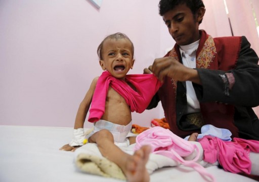 الأمم المتحدة تحذر من أن اليمن على بعد خطوة واحدة من المجاعة