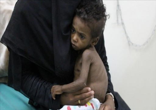 البنك الدولي: 70 بالمئة من اليمنيين يواجهون خطر المجاعة