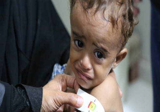 "اليونيسيف": طفل من بين كل ثلاثة دون الخامسة في العالم يعاني من سوء التغذية