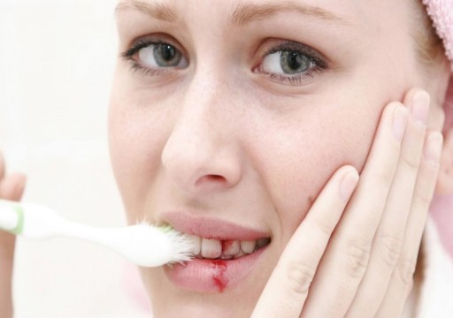 5 علاجات منزلية للتخفيف من آلام الأسنان