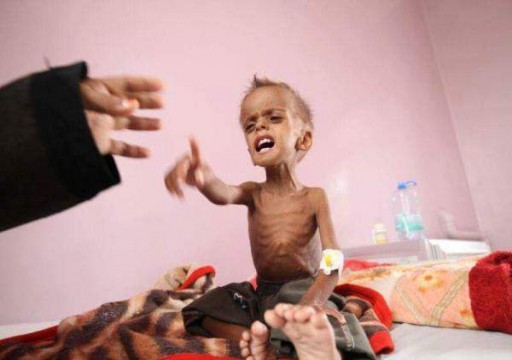 اليمن.. تحذير أممي من ارتفاع مصابي سوء التغذية إلى 3.2 ملايين