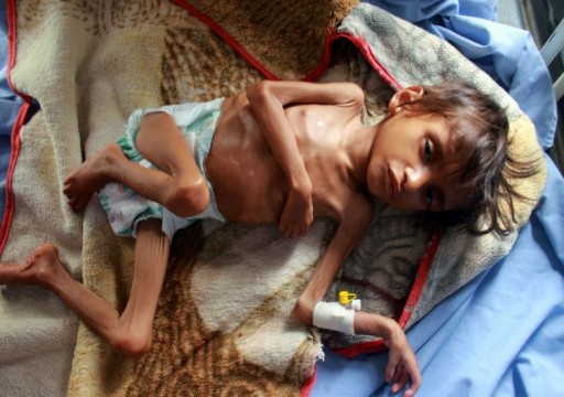 إندبندنت: 2020 سيكون أسوأ أعوام الجوع في اليمن وغارات التحالف دمرت الزراعة