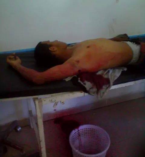 قتيل وستة جرحى وسط اليمن 