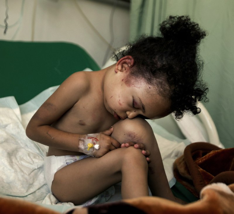 الصليب الأحمر: لن نغضّ الطرف عن ضحايا المدنيين باليمن