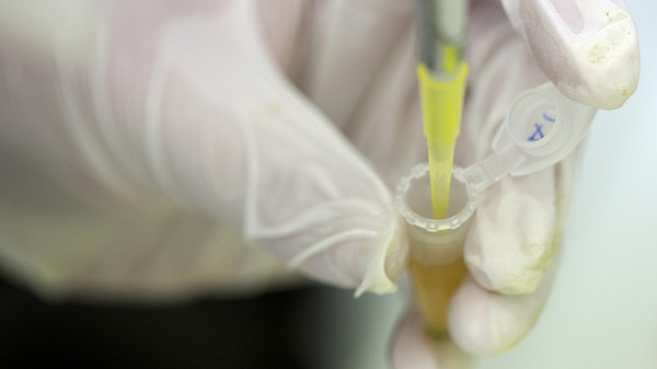 شركة بريطانية تكشف عن علاج لـ"أيبولا"