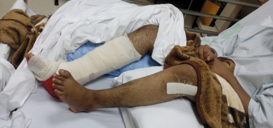 حوادث متزايدة.. إصابة طالب بكسور في ساقيه إثر تعثره على درج المدرسة